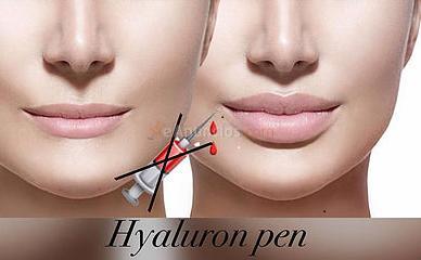 Hyaluron Pen