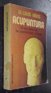 Acupuntura. El secreto de la medicina china