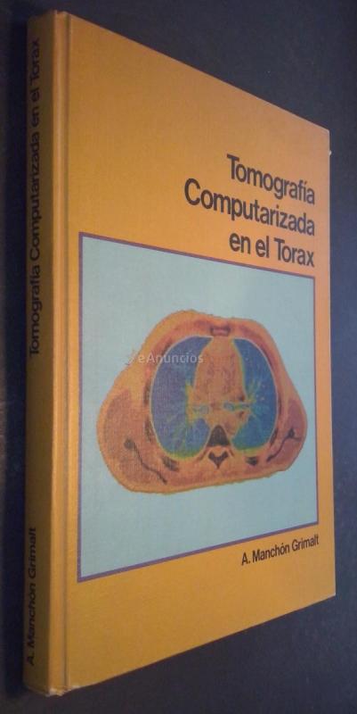 Tomografía computarizada en el tórax